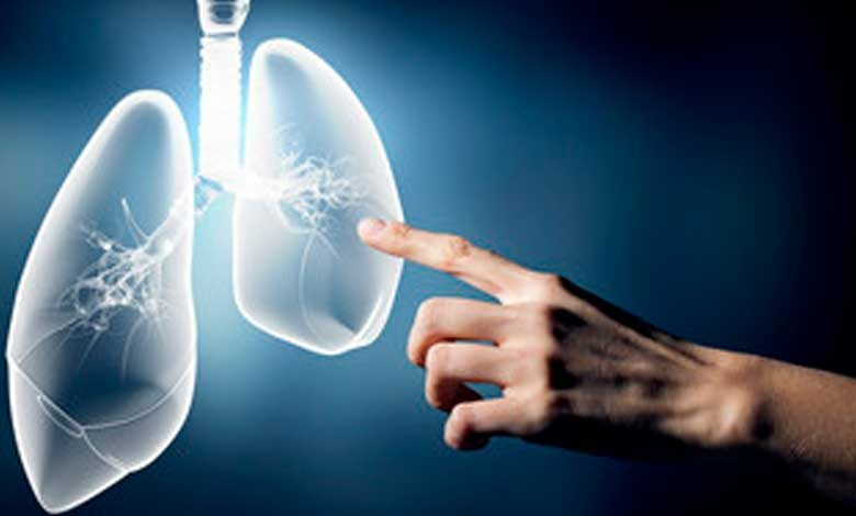 Politécnicos desarrollan sistema para detectar cáncer de pulmón