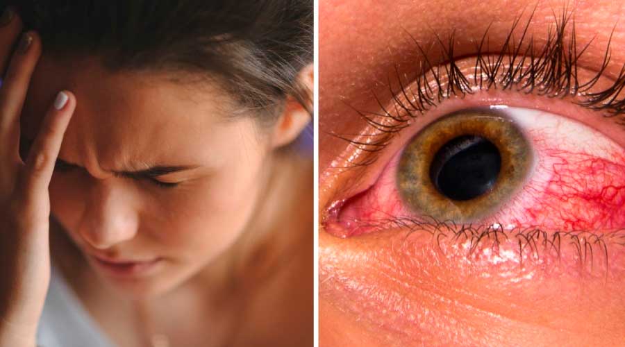 Glaucoma: el enemigo silencioso que puede causar ceguera