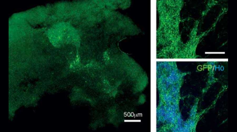 Crean neuronas que pueden integrarse al tejido cerebral humano