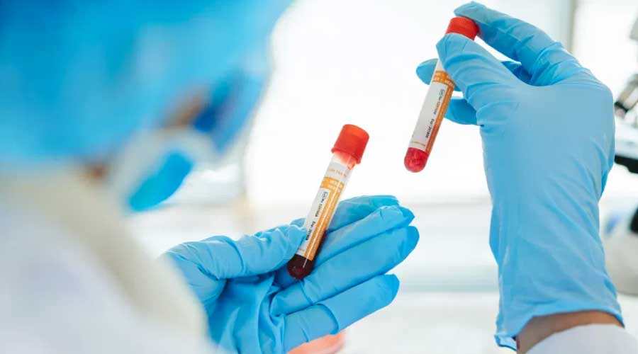 Qué comer según la dieta del tipo de sangre